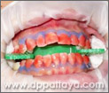 10.สีแดงที่เห็นในภาพคือน้ำยาฟอกสีฟันที่มีความเข้มข้นสูง.