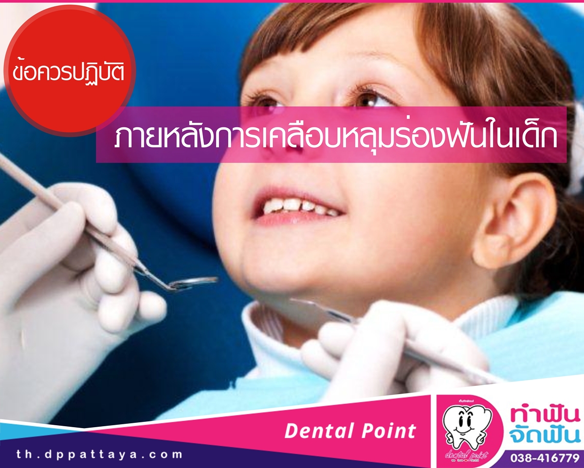 ข้อควรปฏิบัติภายหลังการเคลือบหลุมร่องฟันในเด็ก