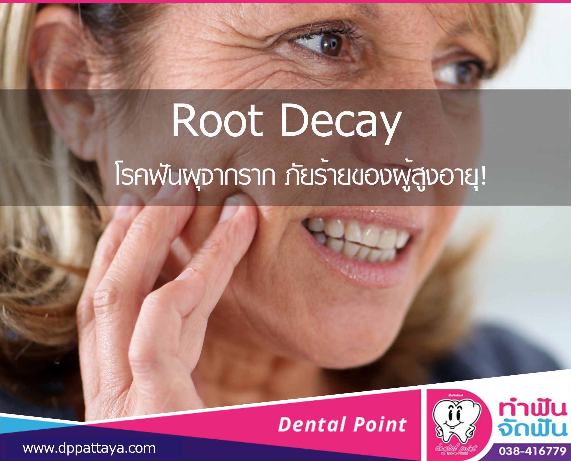 Root Decay โรคฟันผุจากราก ภัยร้ายของผู้สูงอายุ!