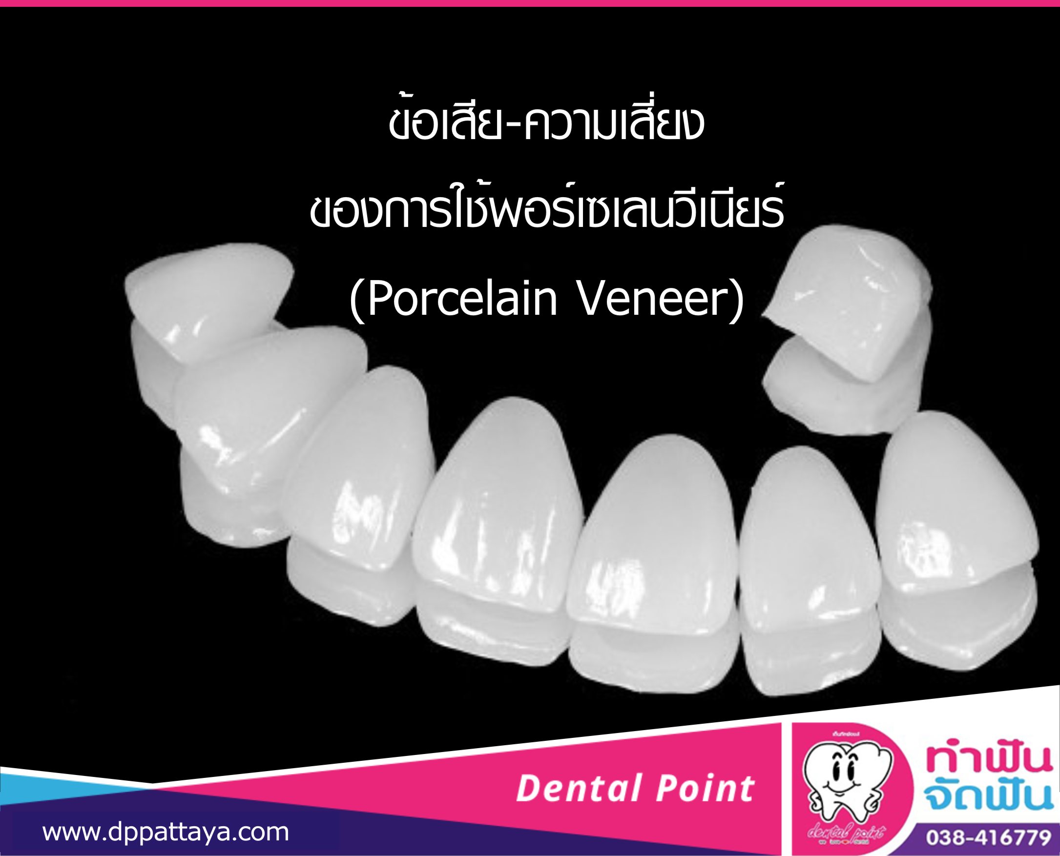 ข้อเสีย-ความเสี่ยงของการใช้พอร์เซเลนวีเนียร์(Porcelain Veneer)