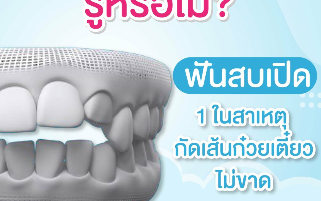 ฟันสบเปิด 1 ในสาเหตุ กัดเส้นก๋วยเตี๋ยวไม่ขาด